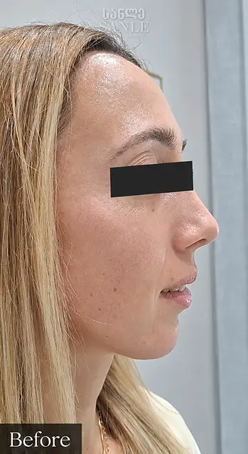 Косметология — До, SANLE Beauty Salon