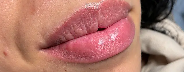 Lip blush (permanent) — Before, SANLE Beauty Salon