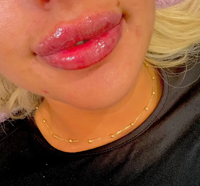 კოსმეტოლოგია — SANLE Beauty Salon, თბილისი
