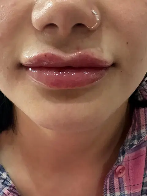 კოსმეტოლოგია — SANLE Beauty Salon, თბილისი