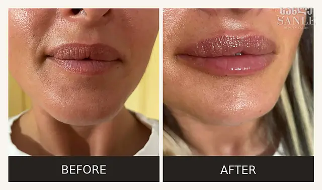 Косметология — SANLE Beauty Salon, Тбилиси