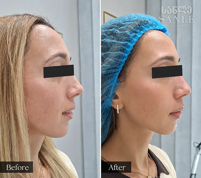 Косметология — SANLE Beauty Salon, Тбилиси