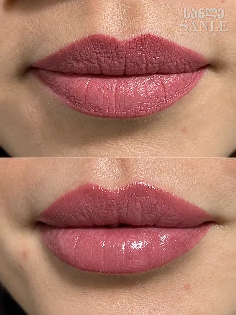 Косметология — SANLE Beauty Salon, Тбилиси
