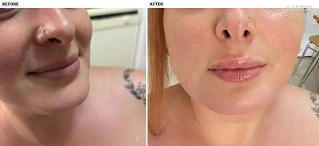 Косметология — SANLE Beauty Salon, Тбилиси