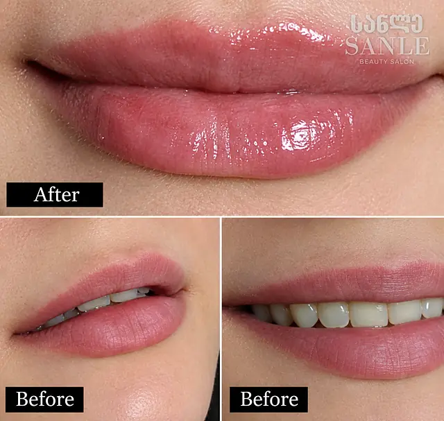 Косметология — SANLE Beauty Salon, Тбилиси