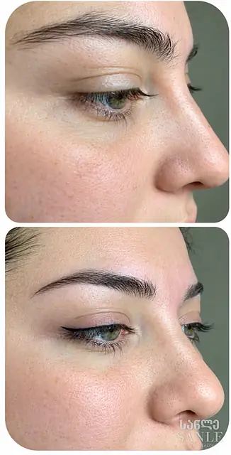 Permanent brows — before and after, work by SANLE